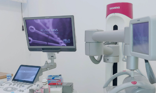 3d ultrazvučni skener dojke